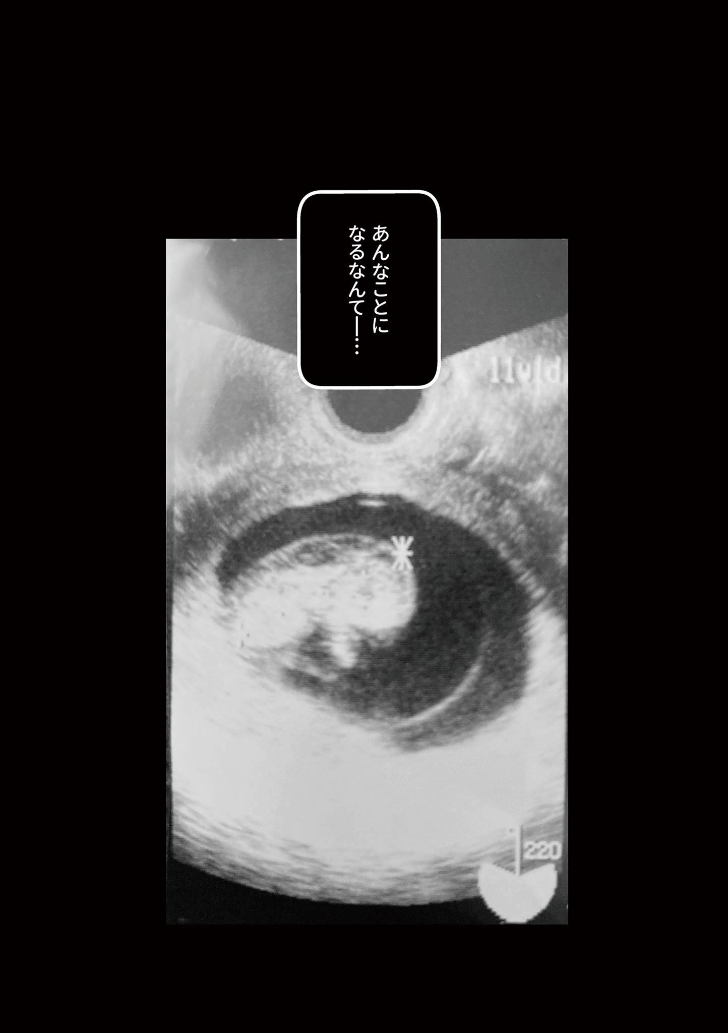 わたしが選んだ死産の話4-3