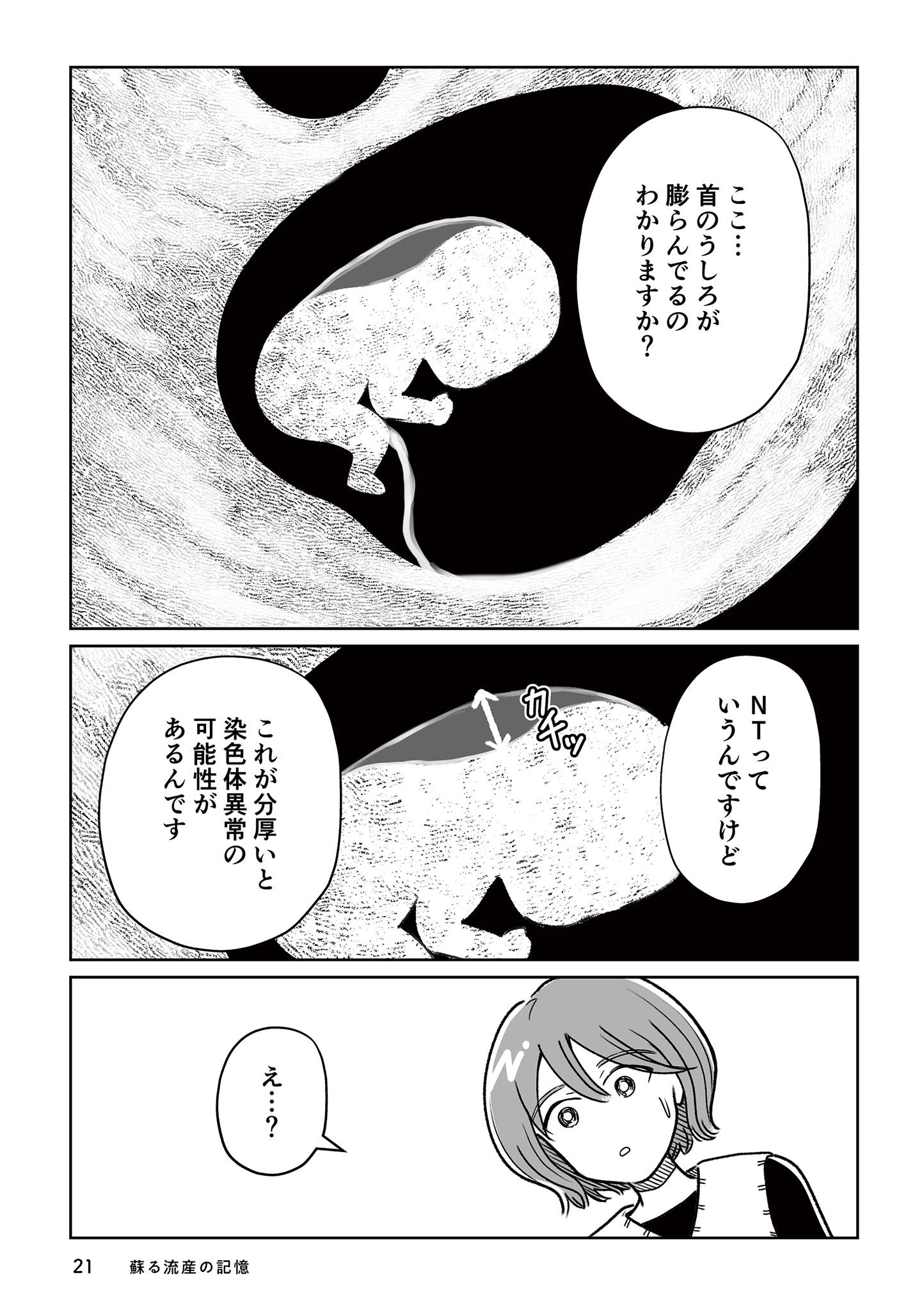 わたしが選んだ死産の話6-2
