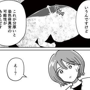 「染色体異常？」予想もしていなかった医師の言葉【わたしが選んだ死産の話⑥】