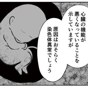 専門医による精密検査を受診。治療法はある？【わたしが選んだ死産の話⑬】