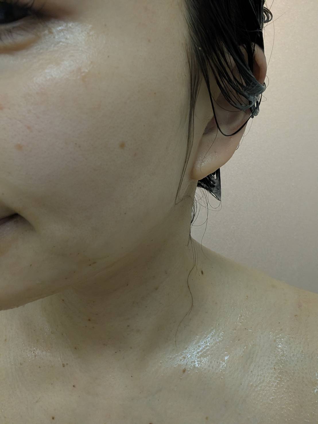 on:myskin(オンマイスキン) ハーブピーリングソリューション for FACEを塗った顔